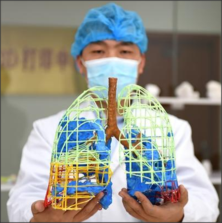 3D打印影像技术与PEEK材料在医学领域的应用