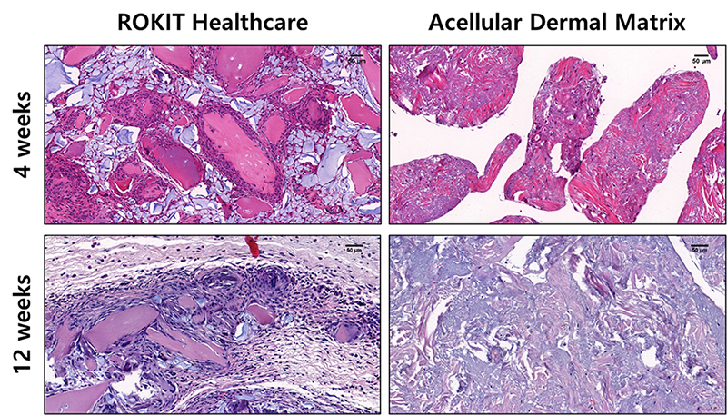 ROKIT Healthcare借生物3D打印技术开发新型软骨再生疗法