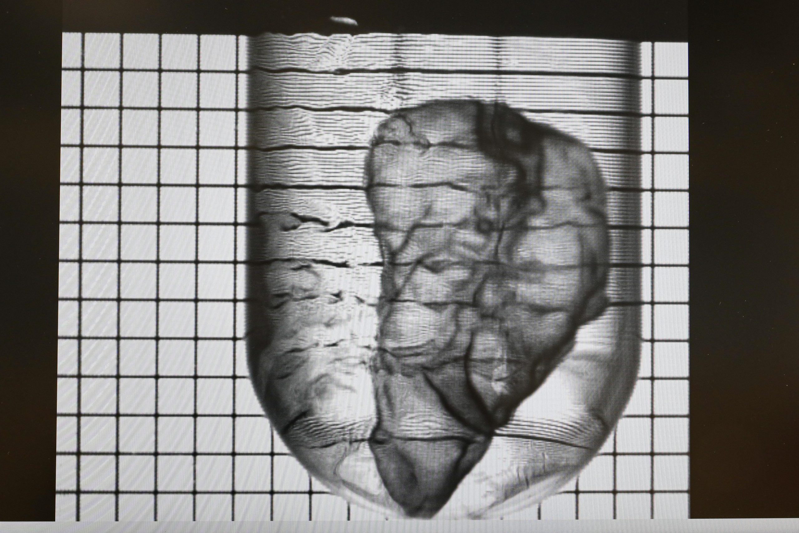 READILY3D 开发出用于糖尿病药物测试的生物3D打印胰腺模型