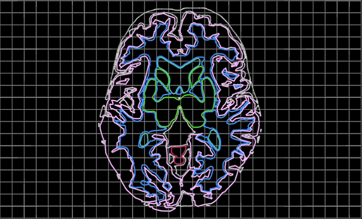 Aether发布其人工智能三维医疗成像软件的新更新