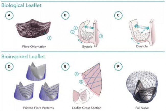 Heart Valve design_Matter