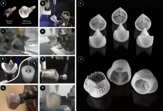 Heart Valve process_Matter